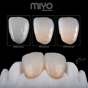 MiYO Kit Color+                   ТЕЧНА КЕРАМИКА  КОМПЛЕКТ ЦВЕТОВЕ